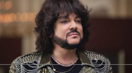 Kirkorov plastik əməliyyat keçirdi - VİDEO 