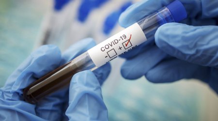 ÜST: COVID-19-la bağlı ölümlər 30% azalıb