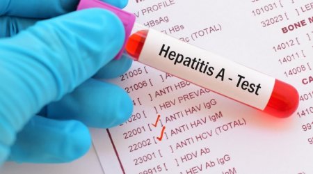 Azərbaycanda Hepatit A virusu ilə bağlı SON DURUM