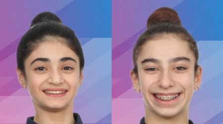 Gimnastlarımız Almaniyada 2 medal qazandılar