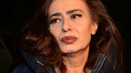 Yıldız Tilbe dişsiz FOTOLARINI paylaşdı