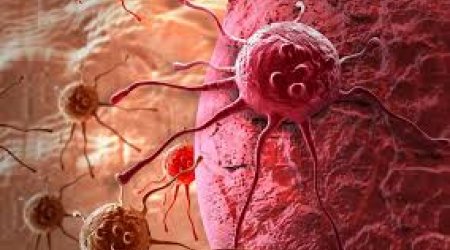 DİQQƏT: Xərçənglə mübarizə üçün yeni üsul KƏŞF EDİLDİ