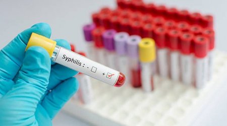 Azərbaycanda 24 uşaq sifilisə necə YOLUXUB? - SENSASİON AÇIQLAMA