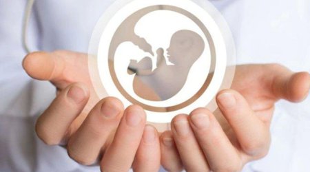 Azərbaycanda dəhşətli STATİSTİKA - 15-17 yaş arası neçə qadın abort etdirib?
