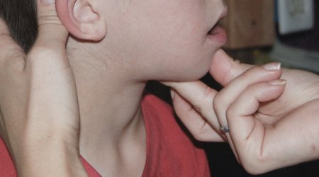 “Çöp” qalma MİFİ – Müasir tibb YOX, xalq ÜSULU?