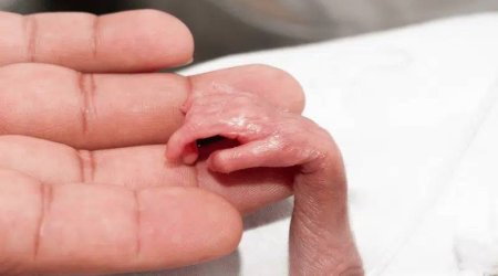 Xəstəxana həyətində 6 aylıq ölü dölün tapılması ilə bağlı TƏBİB-dən AÇIQLAMA