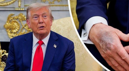 Tramp etiraf etdi: Əlini makiyaj edir &ndash; FOTO