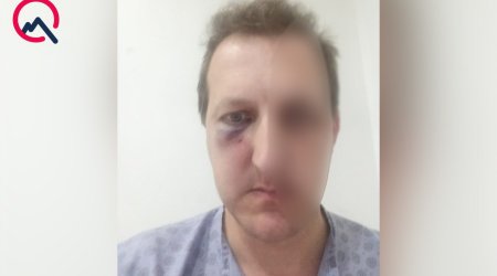 Xalq artistinin oğlu DÖYÜLDÜ