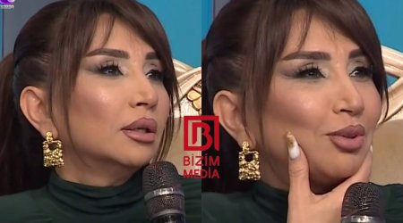 Elnarə Abdullayeva üzgərmə əməliyyatı etdirib? - VİDEO