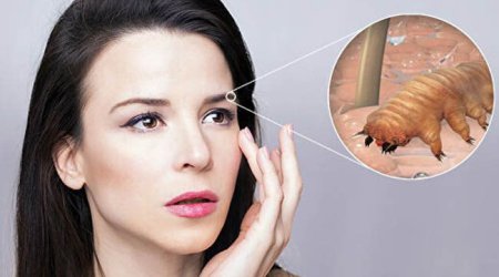 Sinir sistemini məhv edən HƏŞƏRAT - Havalar istiləşdikcə artırlar