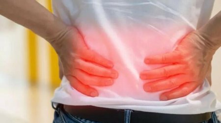 Azərbaycanda böyrək xəstələrinin sayı niyə artıb? - VİDEO