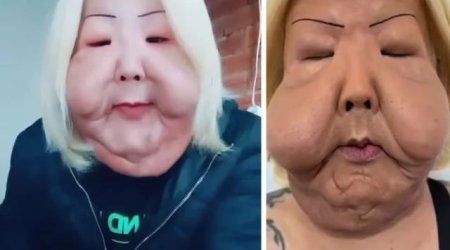 Gözəl olmaq istədi, tanınmaz hala düşdü &ndash; ŞOK FOTOLAR