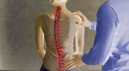 Yeniyetmələrdəki bu problem onurğa əyriliyinə səbəb OLA BİLƏR