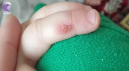 Bakıda tərbiyəçi 3 yaşlı uşağın əlinə dağ basıb &ndash; İDDİA/VİDEO