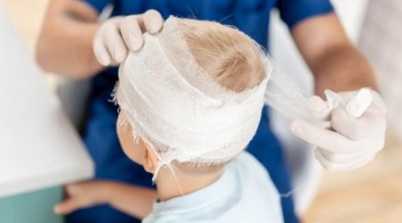 Başındakı problemə görə xəstəxanaya gedən uşağı sünnət etdilər &mdash; Ailəsi 5500 manat təzminat aldı