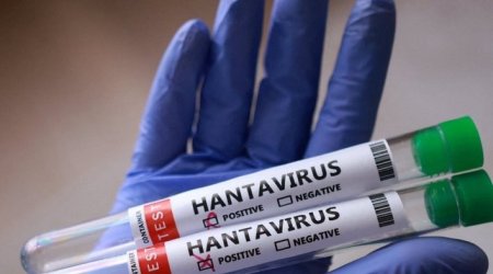 Hantavirusun hansı heyvandan keçdiyi BİLİNDİ &ndash; Bu ölkələrdə olur - FOTO