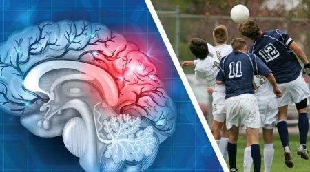 Peşəkar futbolçularda beyin həcmi azalır &ndash; YENİ ARAŞDIRMA