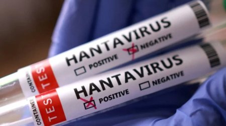 Venesuelada hantavirus həyəcanı: Ölənlər var