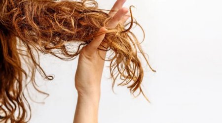 Sizin də saçlarınız qırılır? &ndash; Səbəb daxildən qaynaqlanır