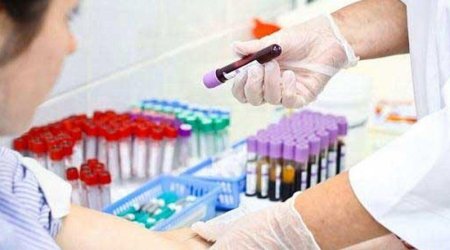 Bu il hepatit diaqnozu qoyulanların sayı AÇIQLANDI