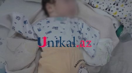 Bakıda ana qolları olmayan körpəsindən imtina etdi - FOTO