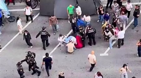 Tədbirdə üzərinə LED ekran aşan qadının SON DURUMU