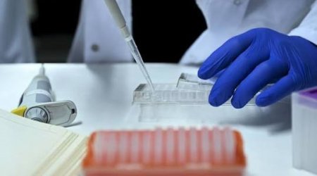 Türkiyədə xərçəng müalicəsi üçün “ağıllı” dərman sistemi hazırlanacaq