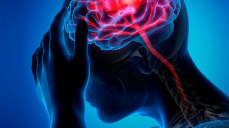 İnsult kasıb insanlarda daha çox rast gəlinir – ALİMLƏRİN QƏNAƏTİ