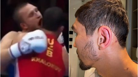 Rusiyalı məşqçi rəqibinin qulağını DİŞLƏDİ