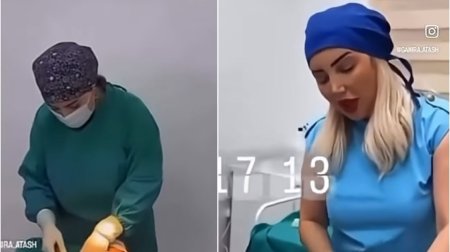 Daha bir saxta həkim qalmaqalı: Katibə cərrahlıq edir? &ndash; VİDEO