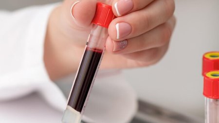 Diabet riski yüksək olan QAN QRUPU açıqlandı