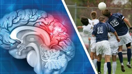 Peşəkar futbolçularda beyin həcmi azalır &ndash; YENİ ARAŞDIRMA
